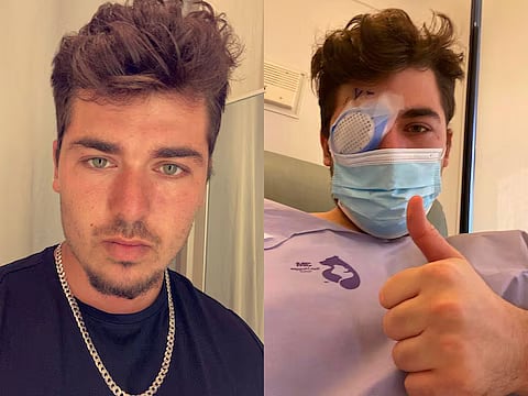 மக்களே உஷார்..! Lens போட்டு தூங்கிய நபர்.. திடீரென காணாமல் போன கருவிழி.. அதிர்ச்சியில் இளைஞர் !