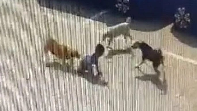 5 வயது சிறுவனை கடித்துக் குதறிய 3 தெரு நாய்கள்.. மனதை பதறவைக்கும் அதிர்ச்சி வீடியோ!