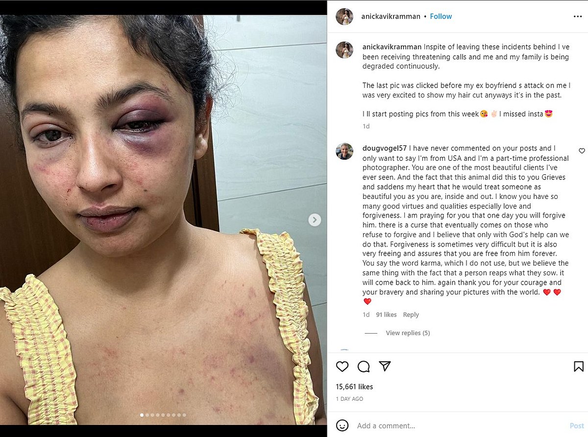 வீங்கிய முகம்.. ரத்த கோரங்களுடன் உடல்: காதலன் தாக்கியதாக இன்ஸ்டாவில் புகைப்படம் பதிவிட்ட தமிழ் பட நடிகை !