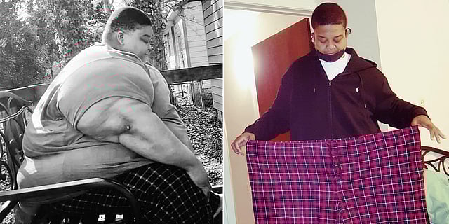 ‘ஏய் எப்புட்றா..’  - டாக்டர் சொன்ன அந்த ஒரு வார்த்தை.. 294 கிலோவில் இருந்து 165 கிலோவாக குறைந்த நபர் !