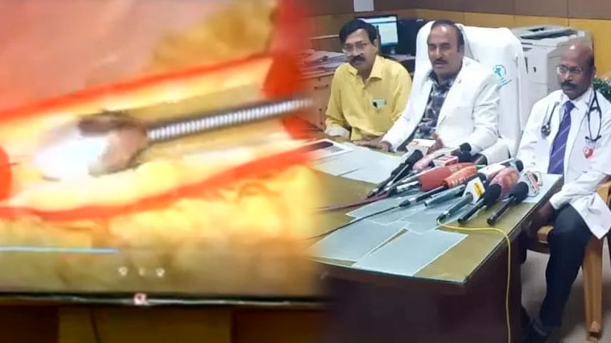 தனியார் மருத்துவமனையில் 8 லட்சம்.. 63 வயது முதியவரின் உயிரை காப்பாற்றி திருச்சி அரசு மருத்துவமனை சாதனை !