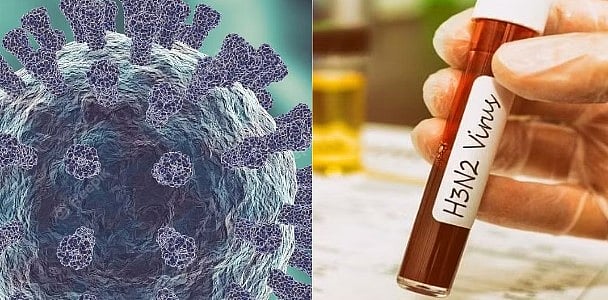 இந்தியாவில் பரவும் H3N2 என்ற வைரஸ்.. தொற்றிலிருந்து நம்மை பாதுகாப்பது எப்படி?: மருத்துவரின் ஆலோசனை என்ன?