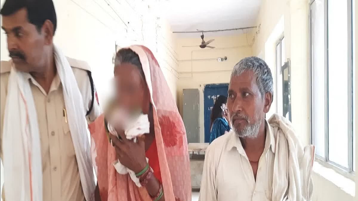 மனைவி மீது கோபம்.. ஆத்திரத்தில் மாமியார் மூக்கை கடித்து துப்பி மருமகன் வெறிச்செயல்.. ம.பி-யில் அதிர்ச்சி