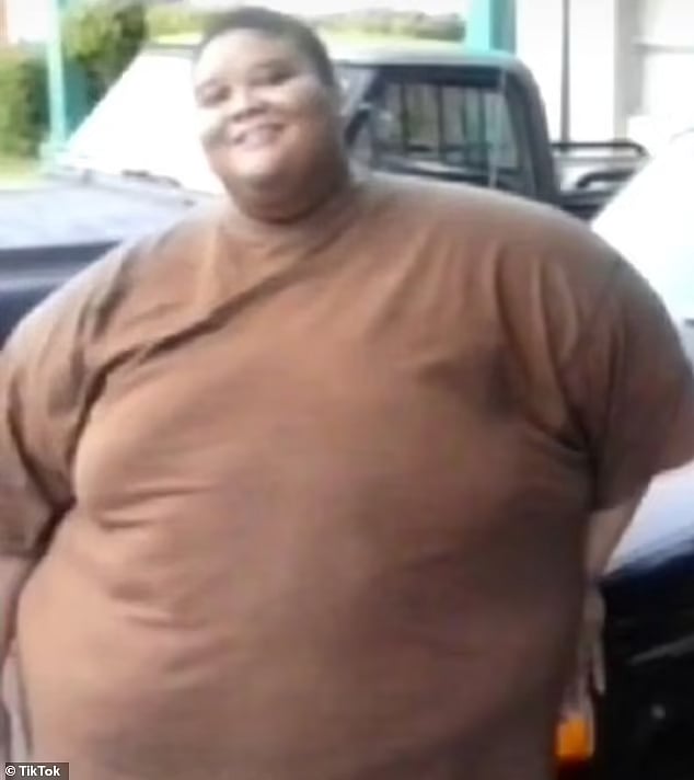 ‘ஏய் எப்புட்றா..’ - டாக்டர் சொன்ன அந்த ஒரு வார்த்தை.. 294 கிலோவில் இருந்து 165 கிலோவாக குறைந்த நபர் !