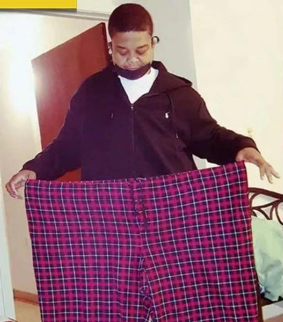 ‘ஏய் எப்புட்றா..’ - டாக்டர் சொன்ன அந்த ஒரு வார்த்தை.. 294 கிலோவில் இருந்து 165 கிலோவாக குறைந்த நபர் !