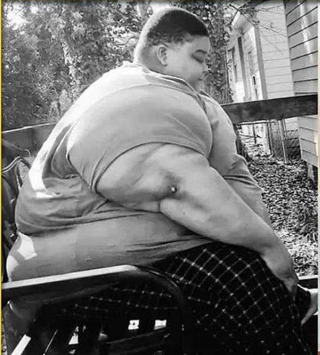 ‘ஏய் எப்புட்றா..’ - டாக்டர் சொன்ன அந்த ஒரு வார்த்தை.. 294 கிலோவில் இருந்து 165 கிலோவாக குறைந்த நபர் !