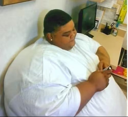 ‘ஏய் எப்புட்றா..’ - டாக்டர் சொன்ன அந்த ஒரு வார்த்தை.. 294 கிலோவில் இருந்து 165 கிலோவாக குறைந்த நபர் !