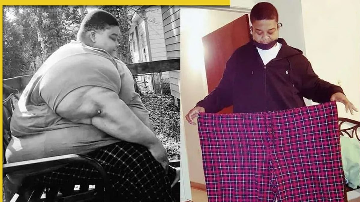 ‘ஏய் எப்புட்றா..’ - டாக்டர் சொன்ன அந்த ஒரு வார்த்தை.. 294 கிலோவில் இருந்து 165 கிலோவாக குறைந்த நபர் !