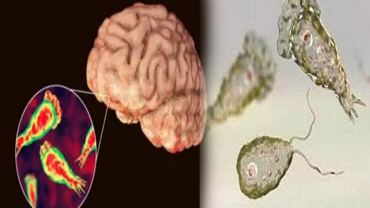  மூளையை உண்ணும் நுண்ணுயிரி.. அமெரிக்காவில்  இளைஞர் பலி.. முகம் கழுவியபோது உடலுக்குள் நுழைந்த கிருமி ! 