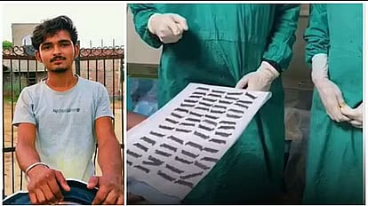 ரத்த வாந்தி எடுத்த இளைஞர்.. வயிற்றில் இருந்த 56 பிளேடுகள்.. பரிசோதனை செய்து அதிர்ந்த மருத்துவர்கள் !