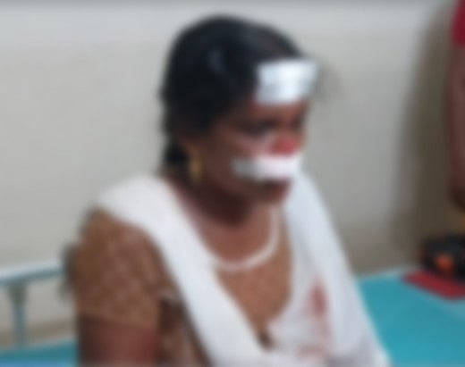 பெண்ணை தாக்கி  தங்க செயின் பறிப்பு.. இளைஞர்களை 4 மணி நேரத்தில் விரைந்து பிடித்த போலிஸ்: குவியும் பாராட்டு