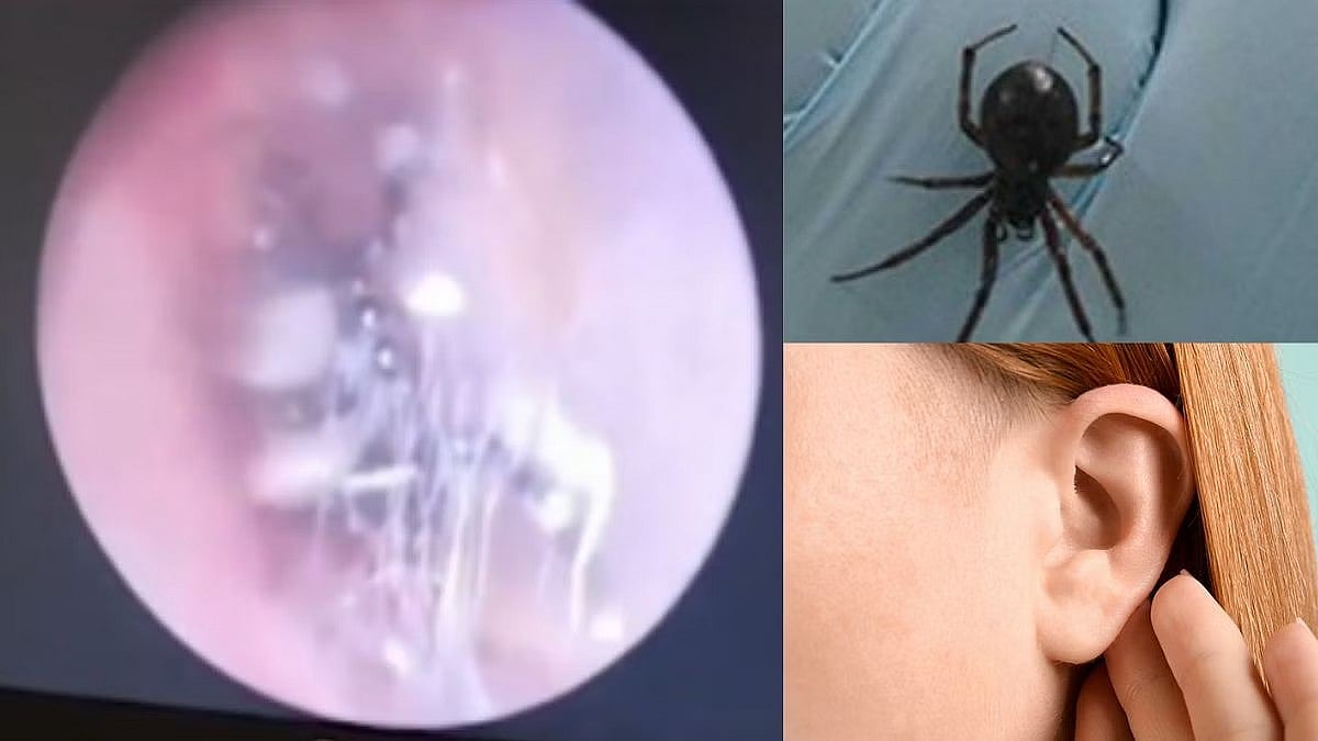 அப்போ மூதாட்டி.. இப்போ இளம்பெண்: காதுக்குள் உயிருடன் கூடு கட்டி வசித்த சிலந்தி-பயங்கரத்தின் பின்னணி என்ன?