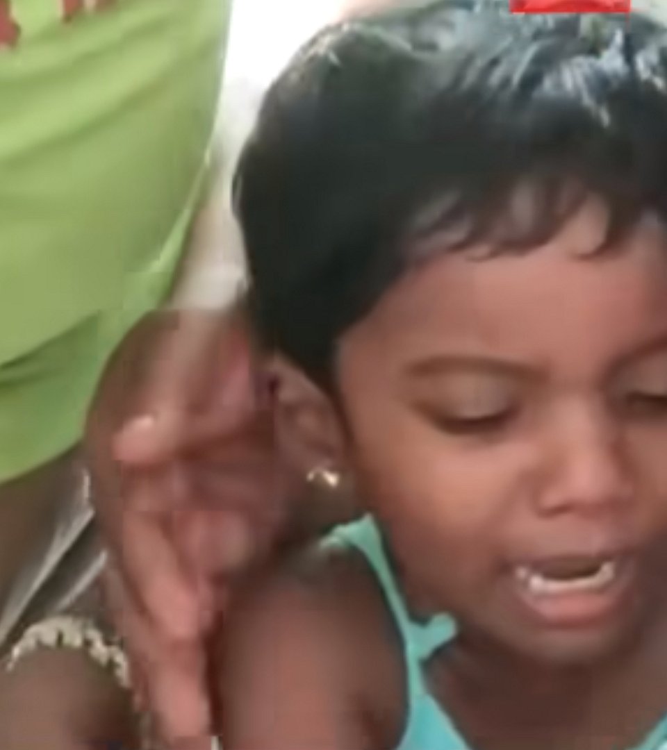 பெற்றோர்களே எச்சரிக்கை ! - விபரீதமான விளையாட்டு.. இட்லி தட்டு ஓட்டைக்குள் சிக்கிய சிறுமியின் விரல் !