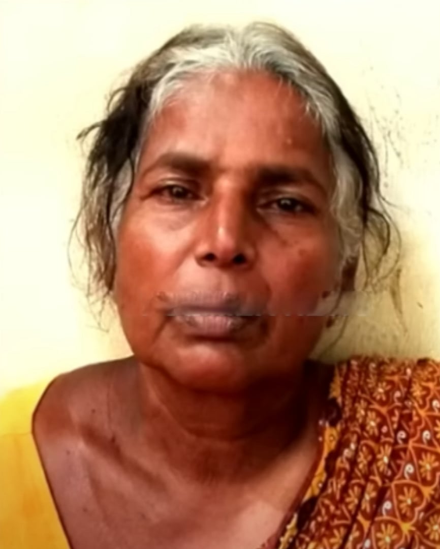 வழுக்கை தலையை ‘விக்’ வைத்து திருமணம்.. கேள்வி கேட்ட புது மனைவியை அடித்தே கொன்ற கணவன்.. நடந்தது என்ன ?