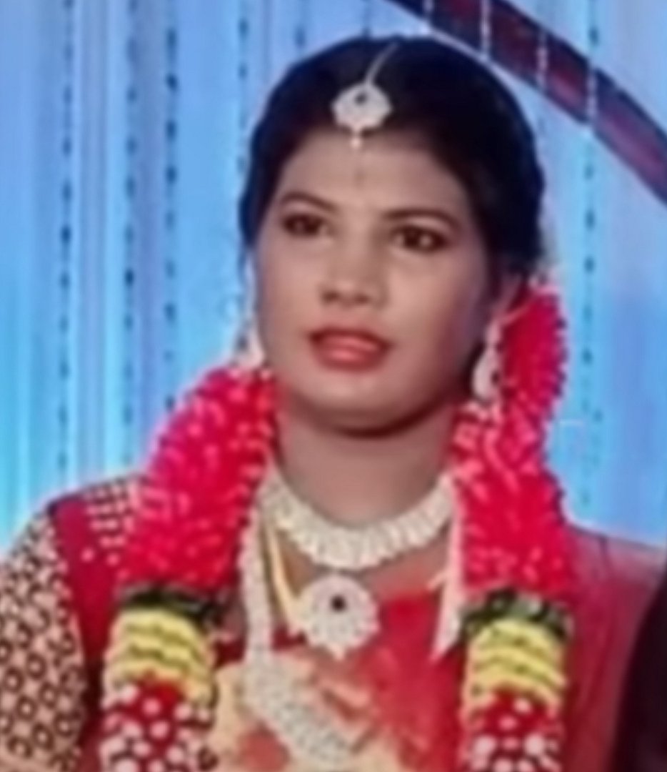 வழுக்கை தலையை ‘விக்’ வைத்து திருமணம்.. கேள்வி கேட்ட புது மனைவியை அடித்தே கொன்ற கணவன்.. நடந்தது என்ன ?