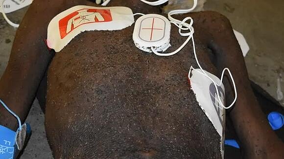 மனிதனை உயிரோடு தின்ற மூட்டை பூச்சிகள்.. அமெரிக்க சிறையில் நடந்த திகில் சம்பவம். பின்னணி என்ன ?