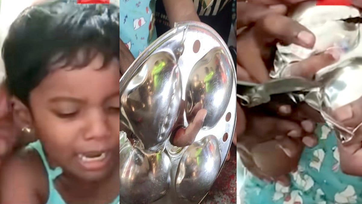 பெற்றோர்களே எச்சரிக்கை ! - விபரீதமான விளையாட்டு.. இட்லி தட்டு ஓட்டைக்குள் சிக்கிய சிறுமியின் விரல் !