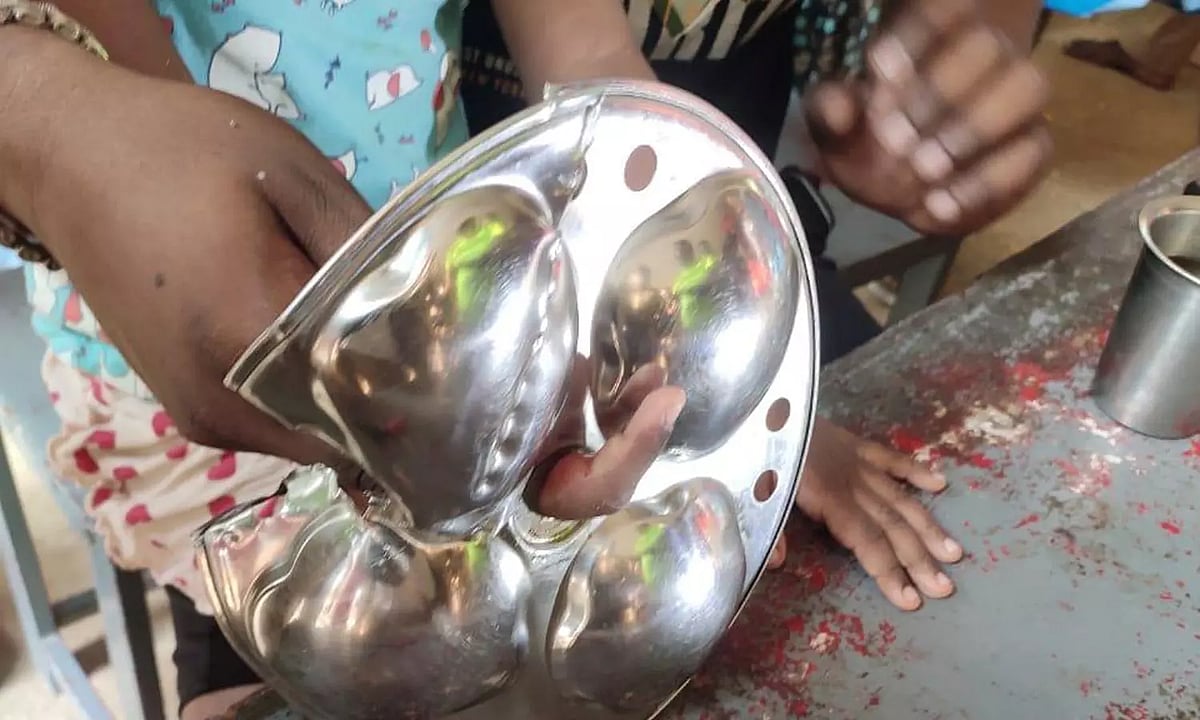 பெற்றோர்களே எச்சரிக்கை ! - விபரீதமான விளையாட்டு.. இட்லி தட்டு ஓட்டைக்குள் சிக்கிய சிறுமியின் விரல் !