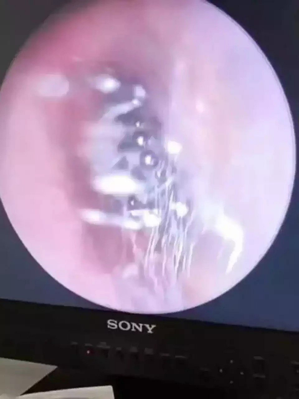 அப்போ மூதாட்டி.. இப்போ இளம்பெண்: காதுக்குள் உயிருடன் கூடு கட்டி வசித்த சிலந்தி-பயங்கரத்தின் பின்னணி என்ன?