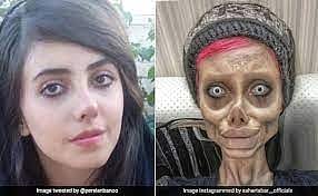அழகான உதடுக்கு ஆசைப்பட்ட இளம்பெண்.. இலவசமாக கிடைத்த Lip Filler மூலம் நேர்ந்த சோகம்.. குமுறும் மாடல் அழகி!