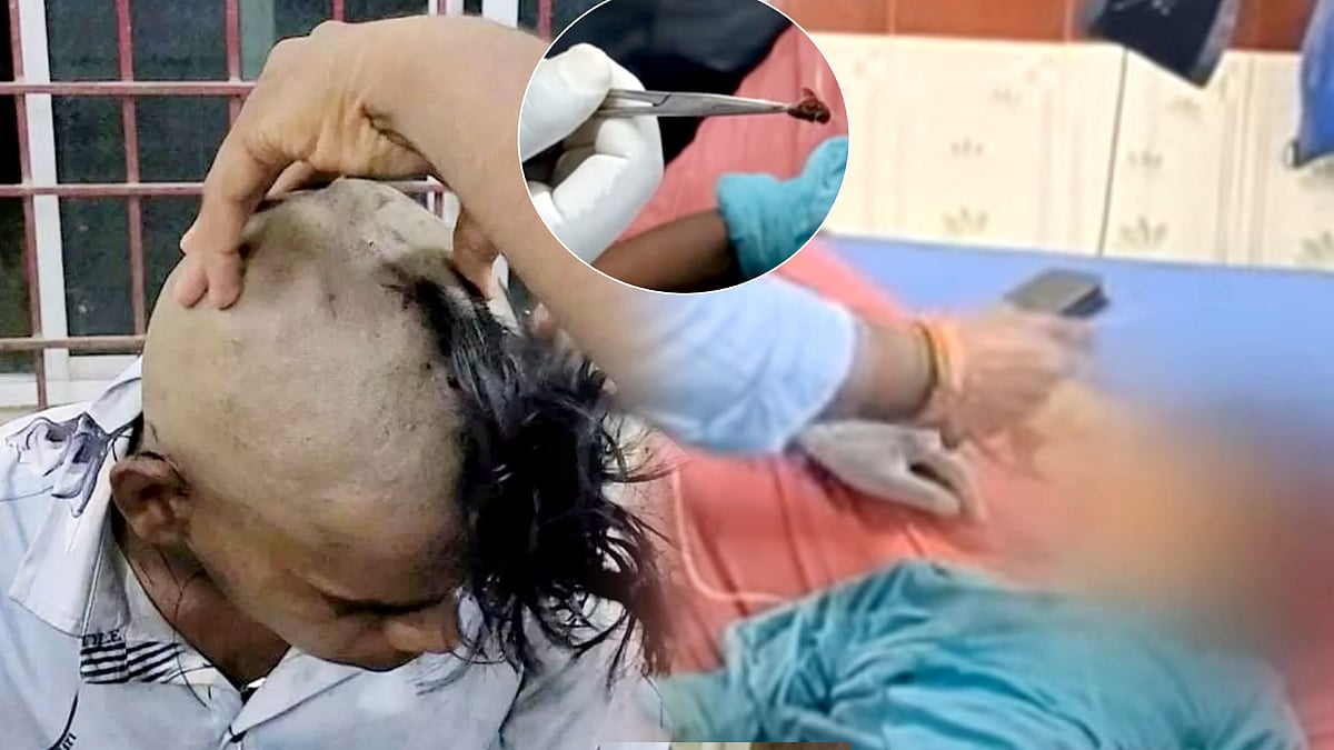 சிறுவனின் காதுக்குள் புகுந்த தேனீ.. உயிருடன் வெளியே எடுத்த மருத்துவர்கள்.. வேலூரில் என்ன நடந்தது ?