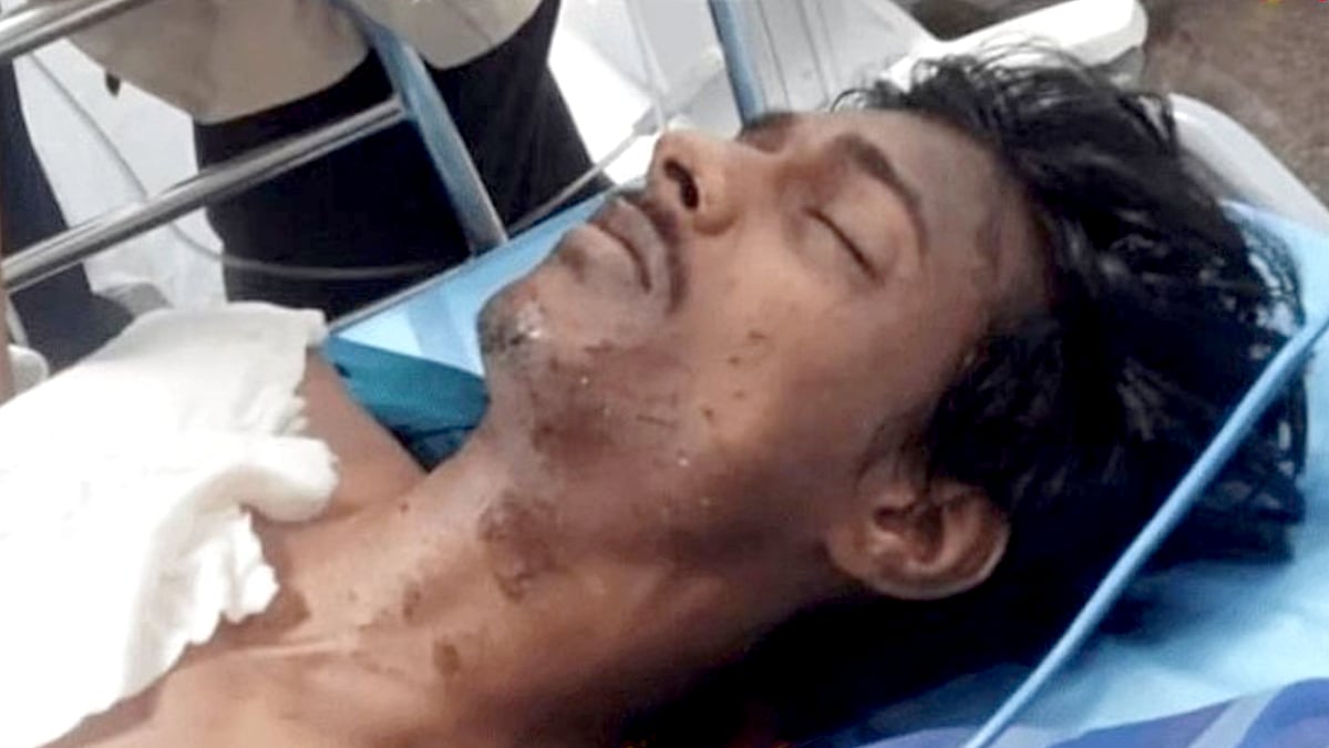 வீட்டில் வெடிகுண்டு தயாரித்த பாஜக இளைஞர்.. வெடித்து சிதறியதில் நேர்ந்த சோகம்.. கேரளாவில் அதிர்வலை !