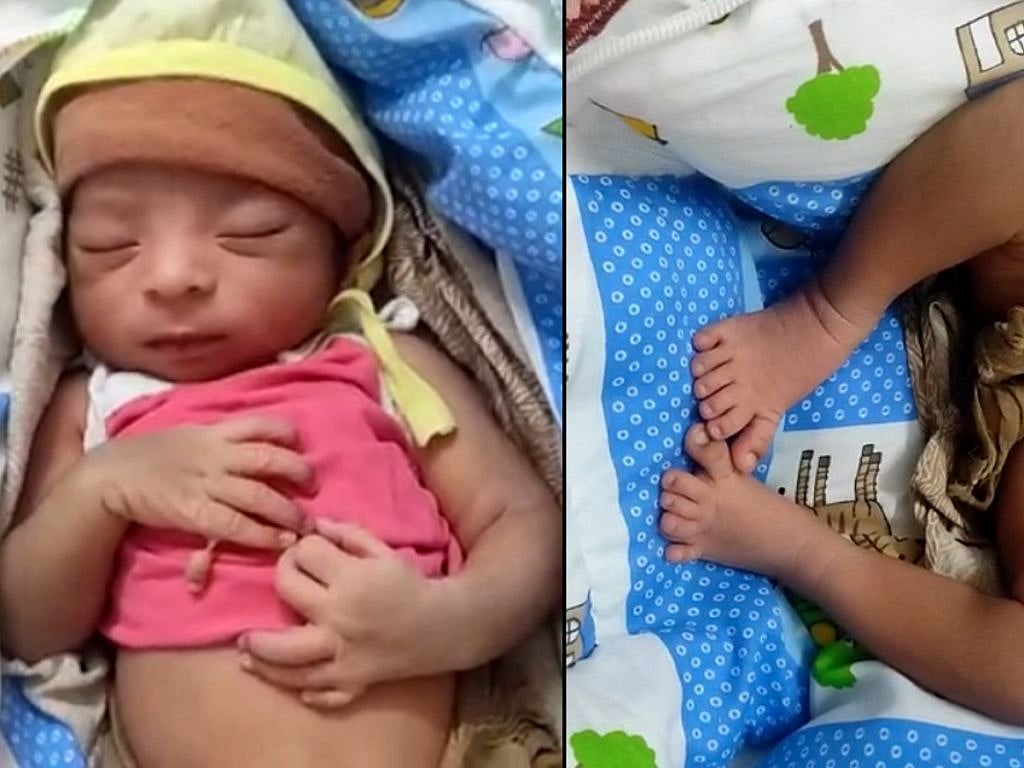 24 விரல்களோடு பிறந்த அதிசய குழந்தை.. பூரிப்புடன் கண்டு களிக்கும் மக்கள்.. எங்கு தெரியுமா ?