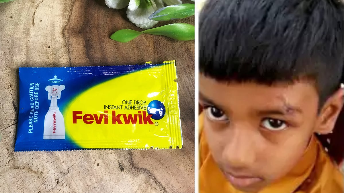 தெலுங்கானா: சிறுவனுக்கு புருவத்தில் ஏற்பட்ட காயம்.. தையலுக்கு பதில் பெவிகுயிக் போட்டு ஒட்டிய மருத்துவமனை!