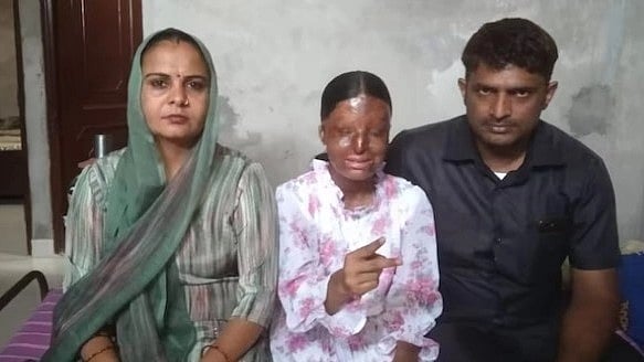 3 வயதில் ஆசிட் வீச்சால் சிதைந்த முகம்..15 வயதில் CBSE 10 வகுப்பு தேர்வில் முதலிடம்: தன்னம்பிக்கை சிறுமி!