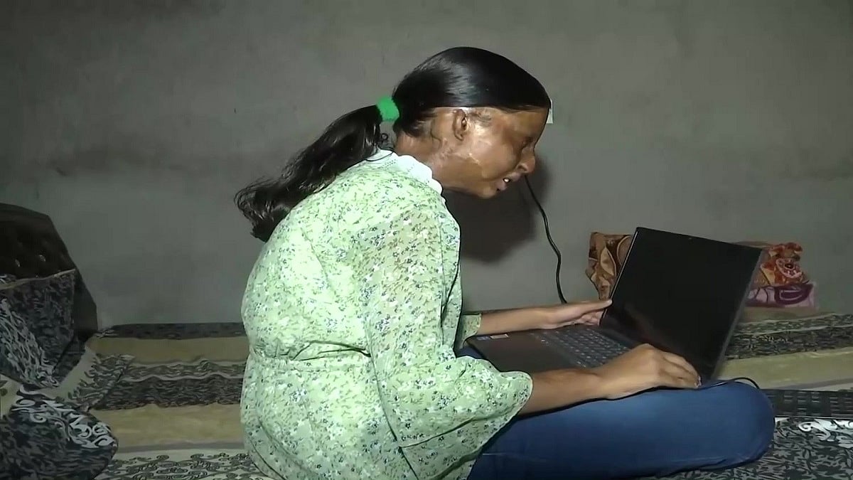 3 வயதில் ஆசிட் வீச்சால் சிதைந்த முகம்..15 வயதில் CBSE 10 வகுப்பு தேர்வில் முதலிடம்: தன்னம்பிக்கை சிறுமி!