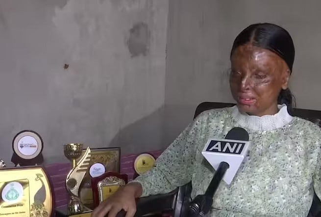 3 வயதில் ஆசிட் வீச்சால் சிதைந்த முகம்..15 வயதில் CBSE 10 வகுப்பு தேர்வில் முதலிடம்: தன்னம்பிக்கை சிறுமி!