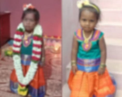 கொதிக்கும் தண்ணீரில் விழுந்த 3 வயது பெண் குழந்தை.. கதறி அழுத தாய்: சோகத்தில் குடும்பம்!