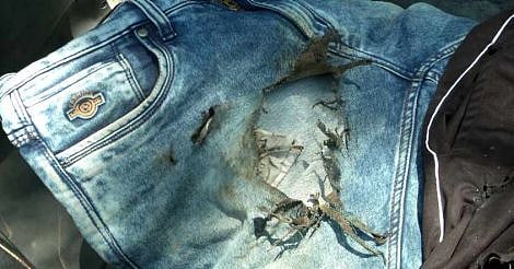 Pant பாக்கெட்டுக்குள் இருந்த போன்.. திடீரென வெடித்ததில் ரயில்வே ஒப்பந்த ஊழியருக்கு நேர்ந்த கொடூரம் !