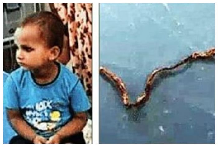 உயிருள்ள பாம்பை வாயால் கடித்து மென்ற சிறுவன்.. அதிர்ந்த மருத்துவர்கள்.. இறுதியில் நடந்தது என்ன ?
