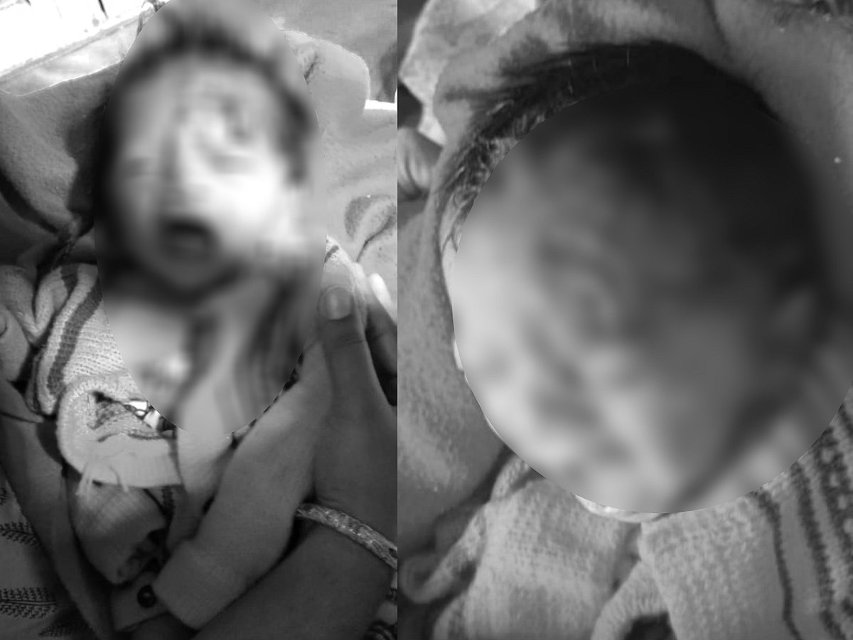 பிறந்து 13 நாட்களே ஆன பச்சிளம் குழந்தை.. குரங்கு தாக்கியதில் நேர்ந்த சோகம்.. கர்நாடகாவில் அதிர்ச்சி !