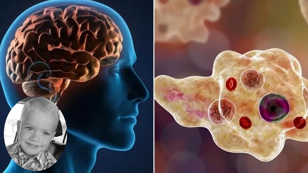 மூளையை தின்னும் அமீபா நோய் தாக்கி மேலும் ஒரு சிறுவன் பலி.. பெற்றோர்களே எச்சரிக்கை !