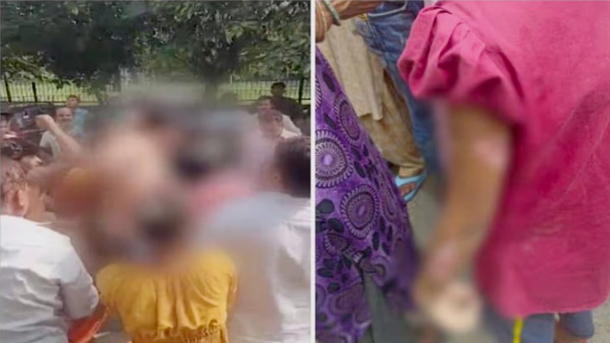 குழந்தையை கவனித்து கொள்ள வந்த சிறுமி.. சூடு வைத்து கொடுமைப்படுத்திய பெண்.. நம்பவைத்து ஏமாற்றிய கொடுமை ! 