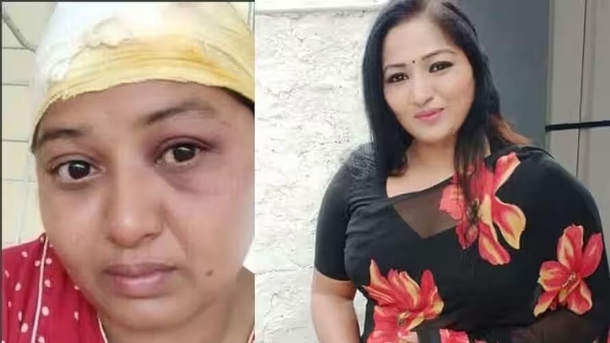 சூடு பிடித்த நிலத்தகராறு.. பிரபல நடிகையின் தலை உடைத்த பெண்.. போலிசார் தீவிர விசாரணை ! - பின்னணி என்ன?