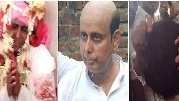 வழுக்கை தலை.. மண மேடையில் அடுத்தடுத்து மண மகளுக்குக் காத்திருந்த 2 அதிர்ச்சி சம்பவங்கள்!