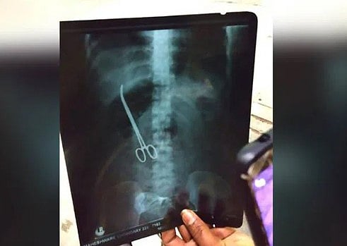 வயிற்று வலி.. மருத்துவமனைக்கு சென்ற பெண்ணுக்கு காத்திருந்த அதிர்ச்சி: 3 மாதம் கழித்து தெரிந்த உண்மை!
