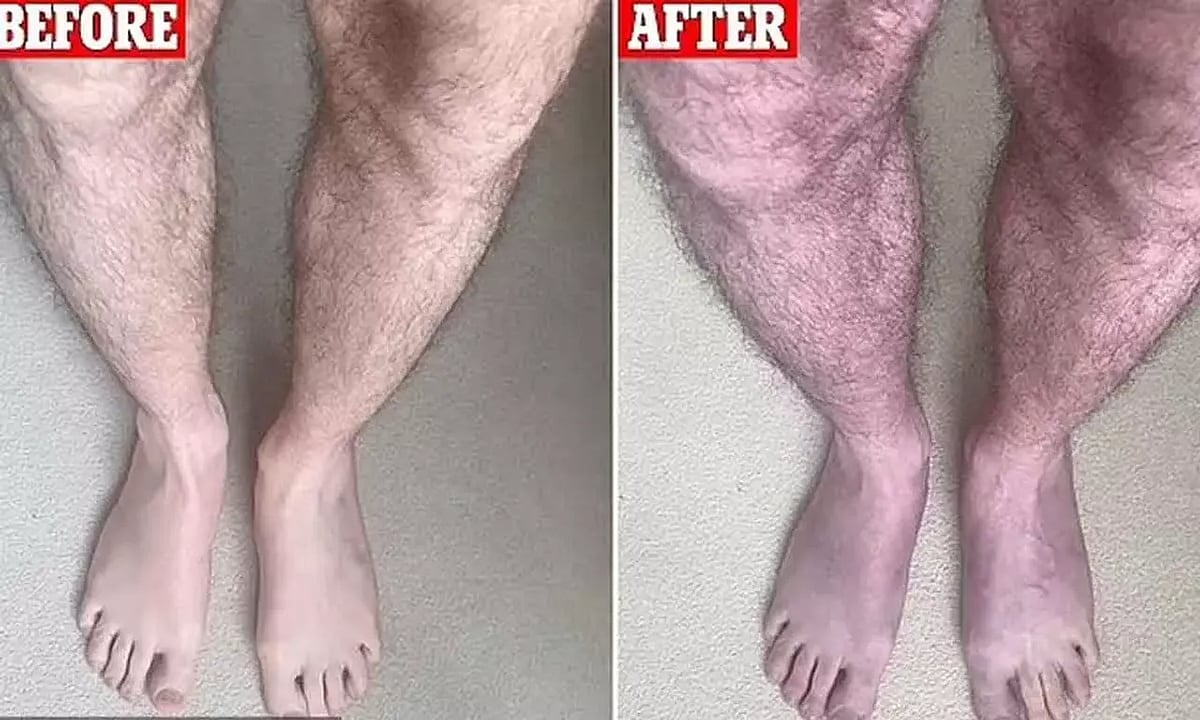 10 நிமிடம் நின்றாலே நீல நிறத்தில் மாறும் கால்கள்.. மக்களுக்கு எச்சரிக்கை விடுக்கும் விஞ்ஞானிகள் !