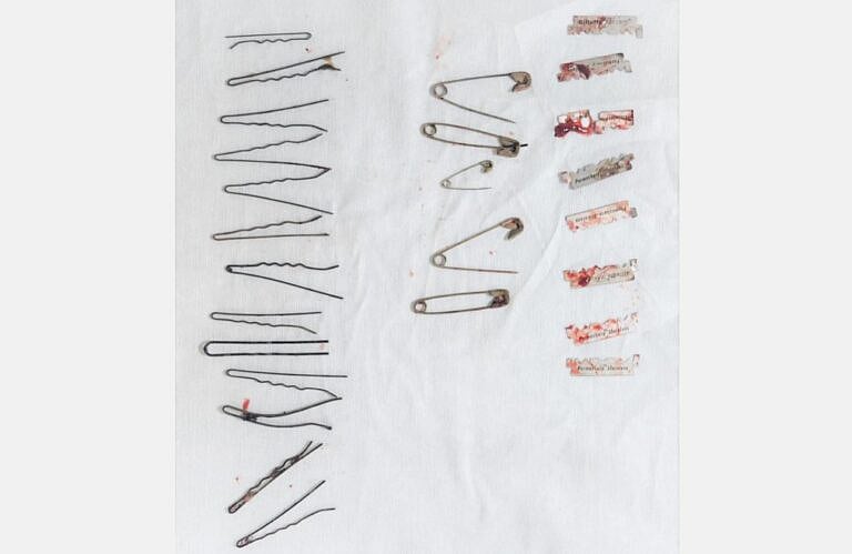 வயிறுவலியால் அவதிப்பட்ட நபர்.. Scan செய்ததில் ஹேர்பின்கள், பிளேடுகள், ஊக்குகளை கண்டறிந்த மருத்துவர்கள்!