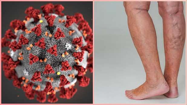 10 நிமிடம் நின்றாலே நீல நிறத்தில் மாறும் கால்கள்.. மக்களுக்கு எச்சரிக்கை விடுக்கும் விஞ்ஞானிகள் !