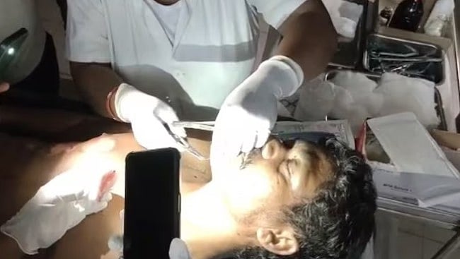 மின்வெட்டு.. செல்போன் டார்ச் வெளிச்சதில் நோயாளிகளுக்கு அறுவை சிகிச்சை: ஆந்திராவில் தொடரும் அவலம்!