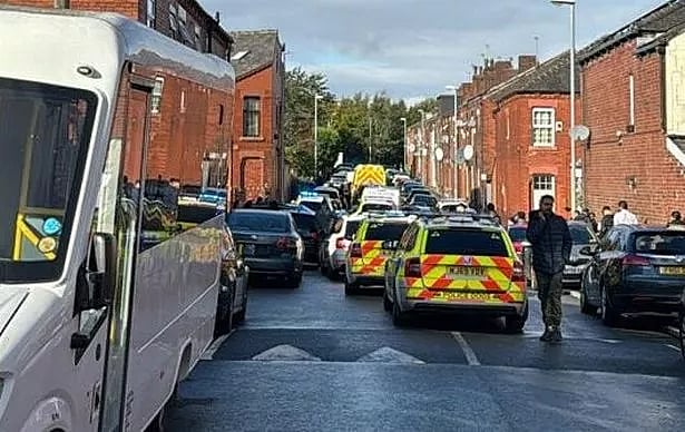 11 வயது சிறுவனை கொடூரமாக கடித்த தெரு நாய்.. 3 மணி நேரம் செய்யப்பட்ட அறுவை சிகிச்சை.. பிறகு நடந்தது என்ன ?