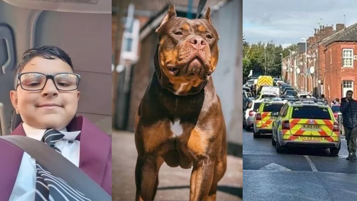 11 வயது சிறுவனை கொடூரமாக கடித்த தெரு நாய்.. 3 மணி நேரம் செய்யப்பட்ட அறுவை சிகிச்சை.. பிறகு நடந்தது என்ன ?