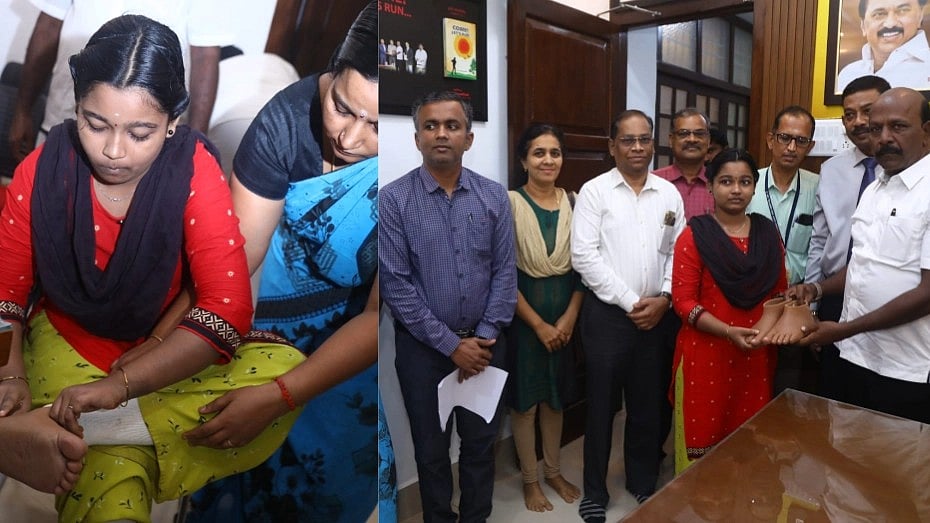 அரியவகை நோயால் கறுத்துப்போன கால்கள் : 10 மாதம் சிகிச்சை - சிறுமியை மீண்டும் நடக்கவைத்த தி.மு.க அரசு!