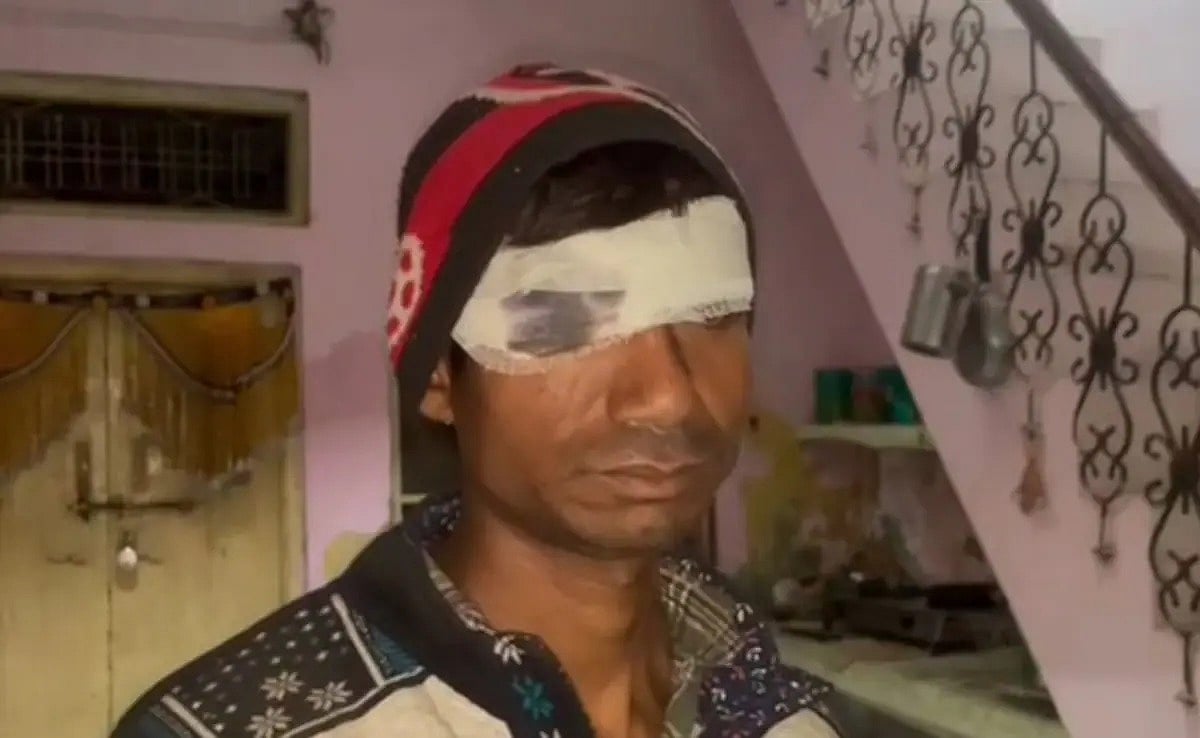 செல்போனை பிடுங்கிய கணவன்... ஆத்திரத்தில் கத்தரிக்கோலால் கண்ணில் குத்திய மனைவி - உ.பியில் அதிர்ச்சி !