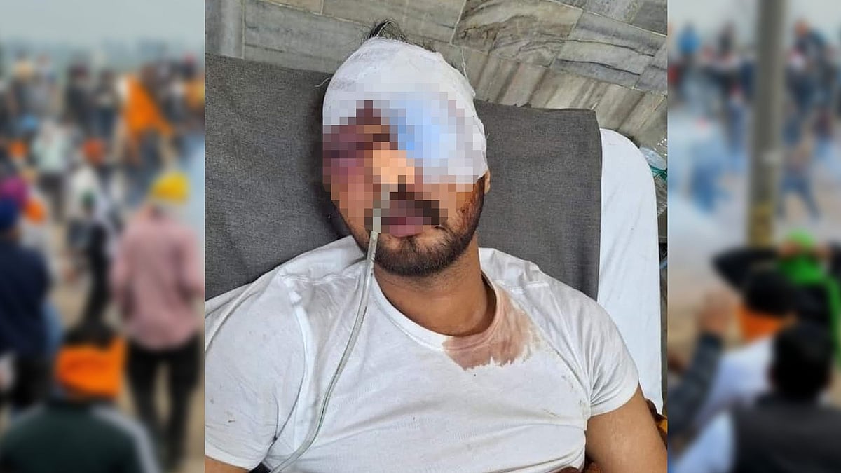 ரப்பர் குண்டு தாக்குதல் - 3 விவசாயிகள் பார்வை இழப்பு : மோடி அரசின் கொடூர முகம்!