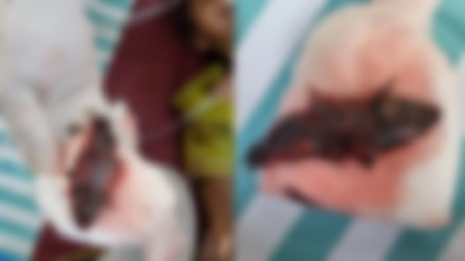 பெற்றோர்களே உஷார் - குழந்தையின் தொண்டையில் சிக்கிய 10 செ.மீ  மீன் : நடந்தது என்ன?